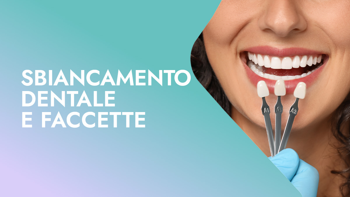 Sbiancamento dentale