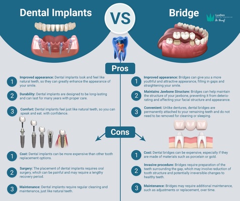 DENTAL IMPLANTS