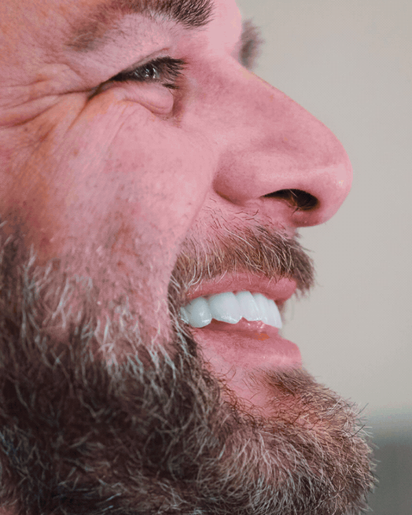 Smile Gallery