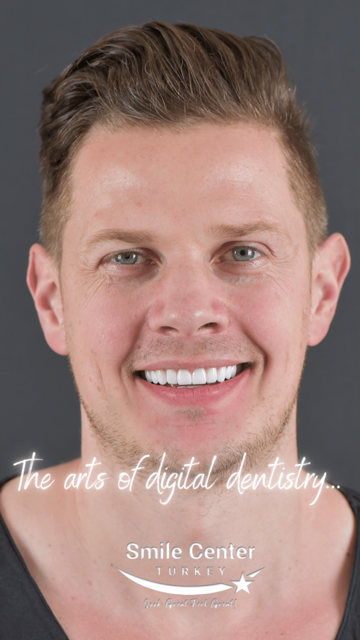 Dental Clinic in Turkey